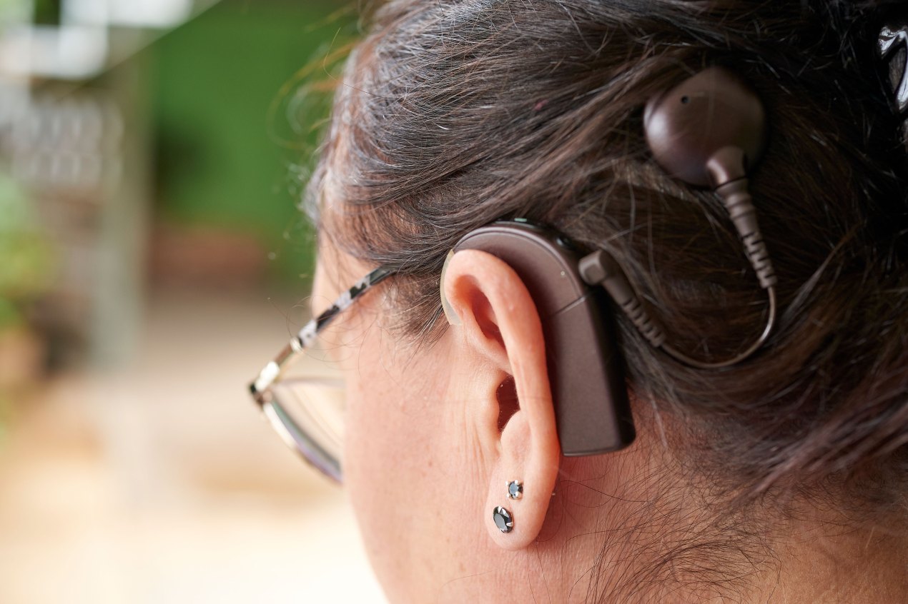 A closeup shot of the side of a woman with a cochlear implant who is also wearing reading glasses.